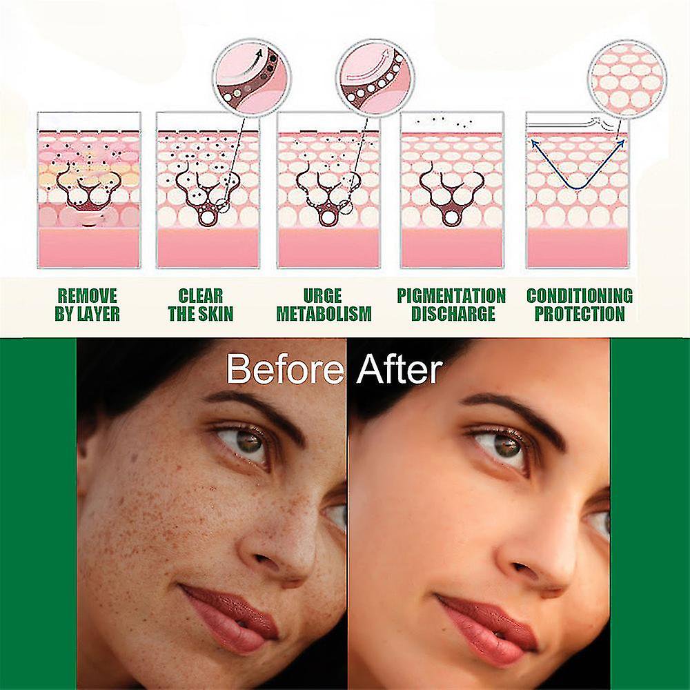 AXIS-Y Dark Spot Correcting Glow Serum 50ml AXIS-Y Dark Spot Correcting Glow Serum 50ml - Image 4